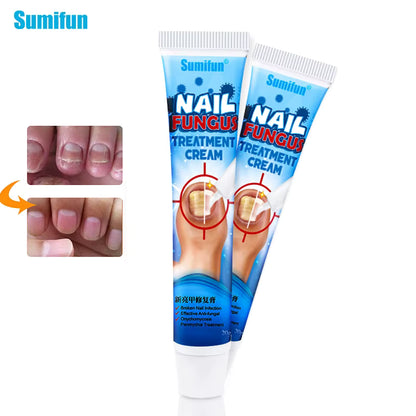 كريم علاج فطريات الأظافرPro™ NailRegen