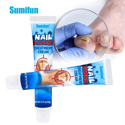 كريم علاج فطريات الأظافرPro™ NailRegen